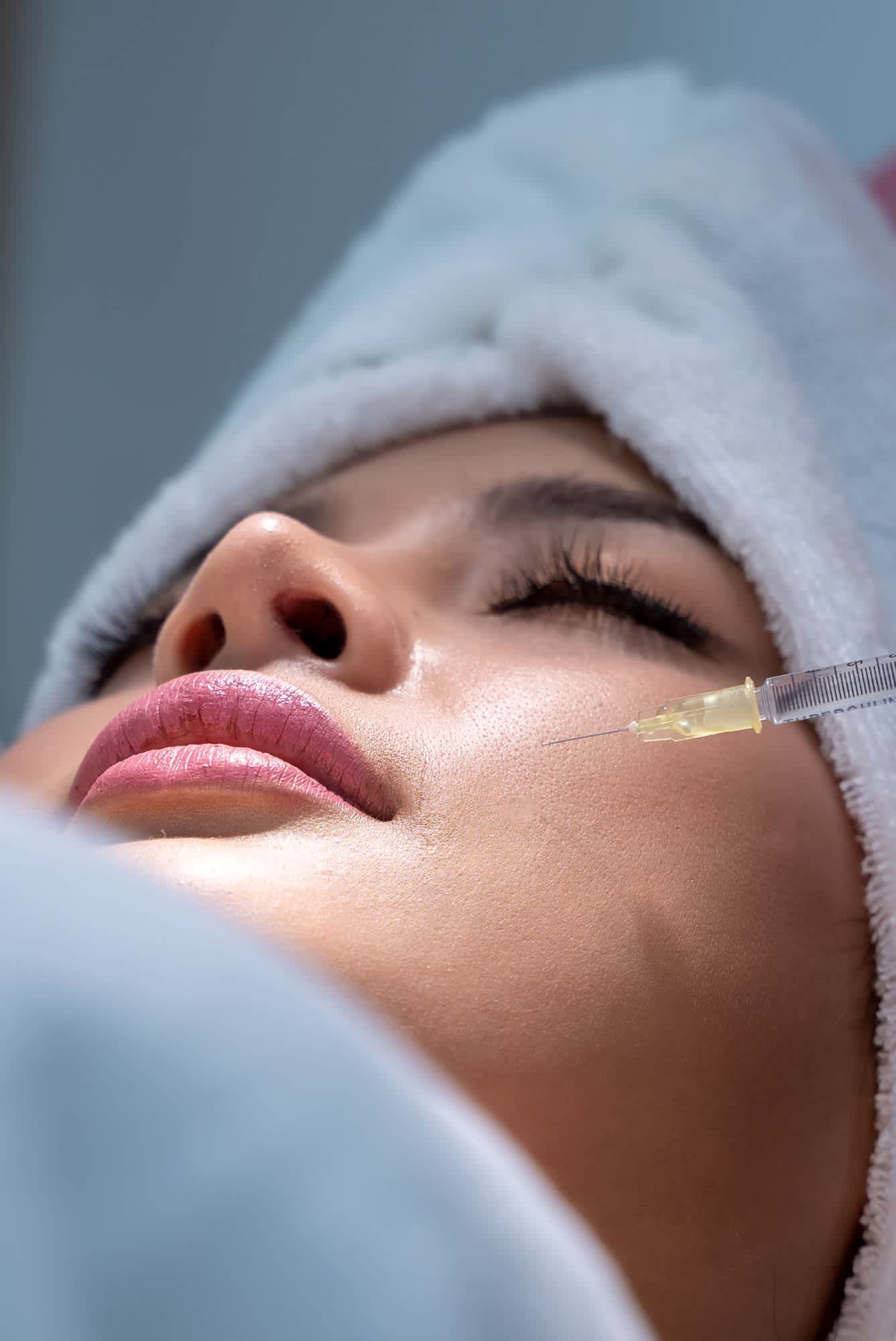 dermal fillers