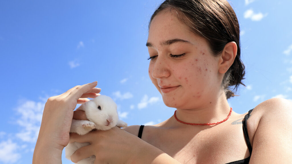 Girl with acne smiling and petting rabbit